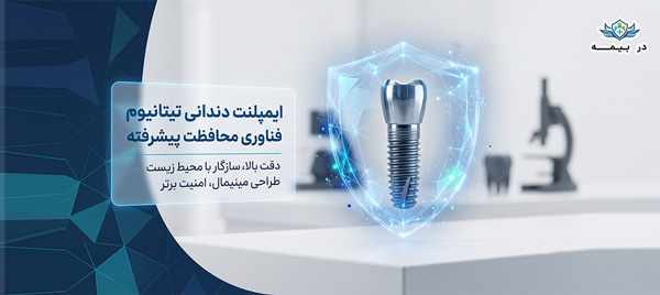 انواع پوشش ایمپلنت بیمه دی